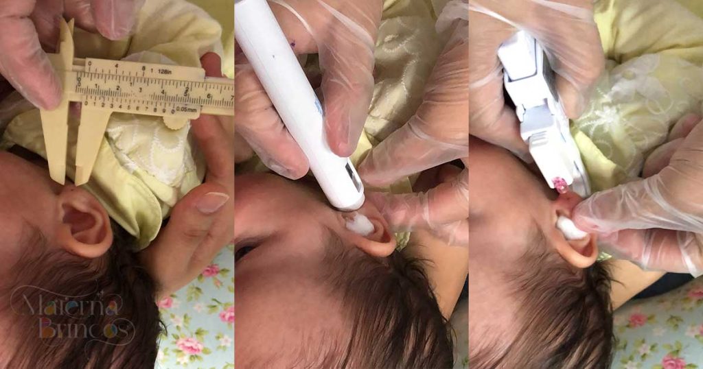 Sistemas de Perfuração e Brincos Antialérgicos